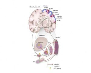 我国科学家世界首次发现帕金森病底层功能网络机制